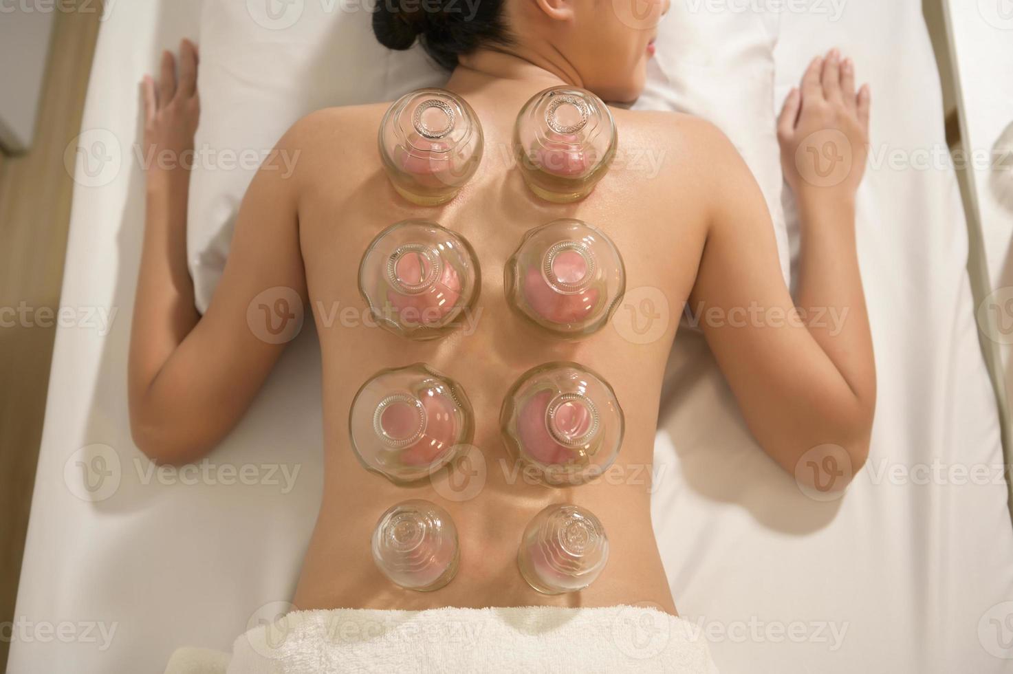 hermosa mujer recibió tratamiento de ventosas en la espalda por parte de un terapeuta, tratamiento de medicina china, concepto de salud y curación. foto