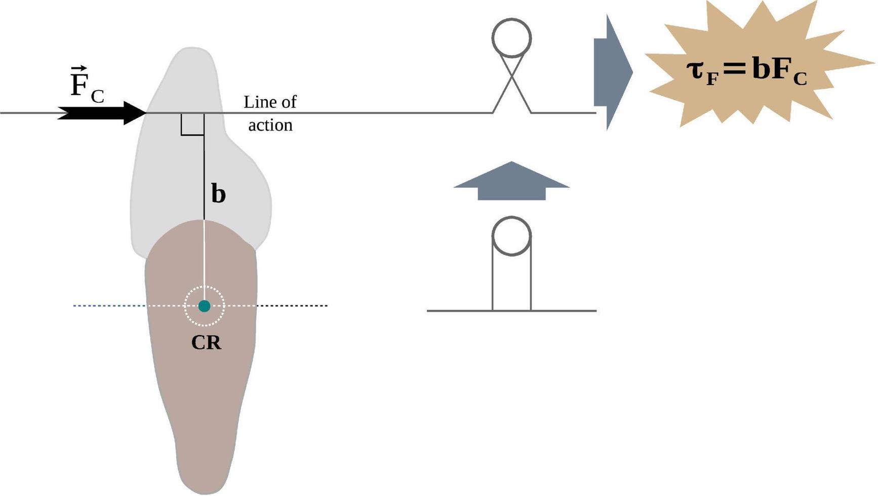 Orthodontic forces on the dental crown and the resultant torque vector