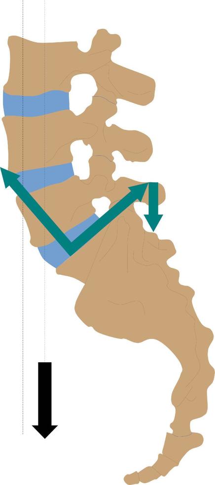 contrapeso del momento de flexión en la columna vertebral por acción muscular vector