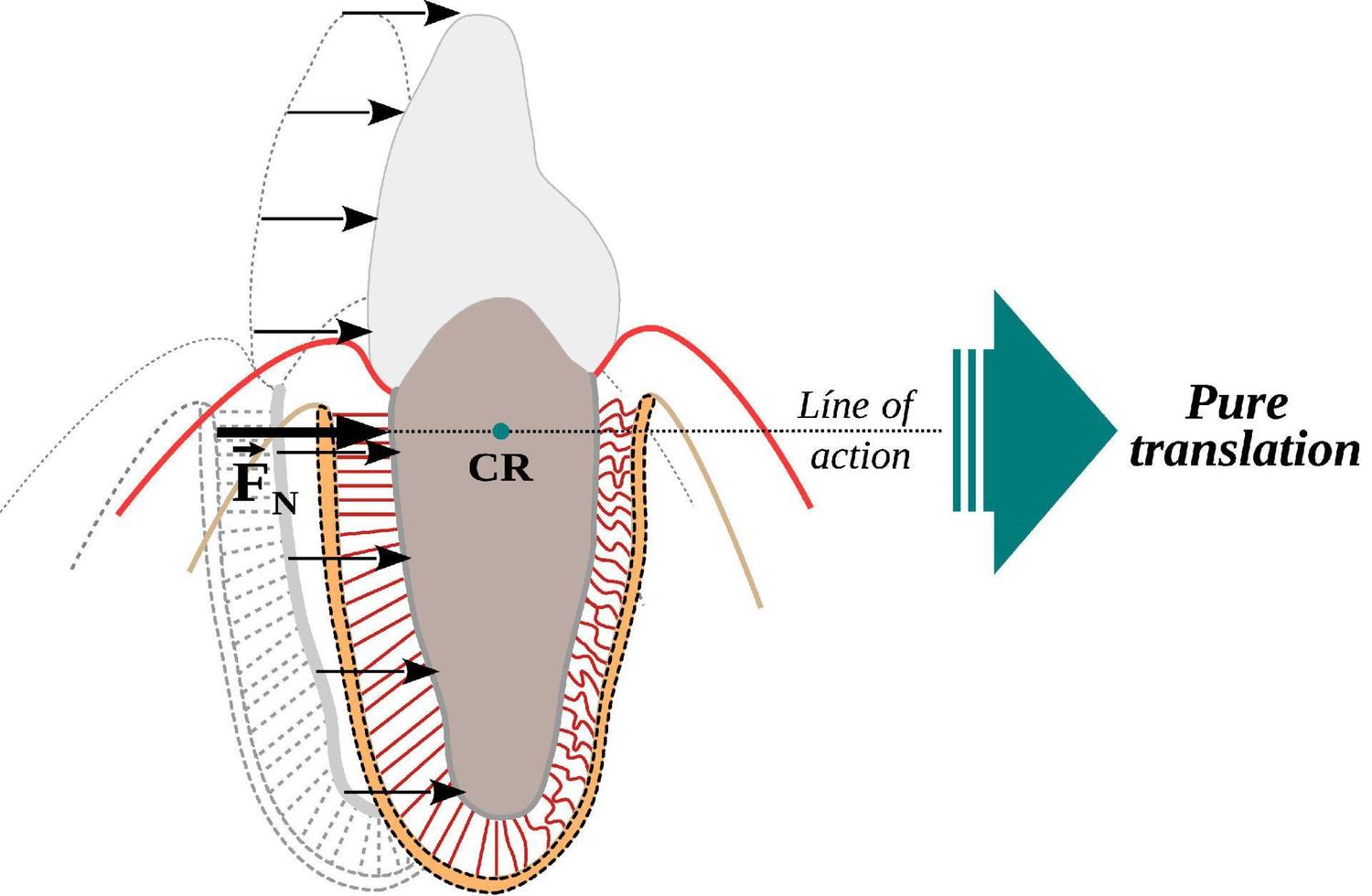 Center of resistance in a tooth and Translation or bodily movement vector