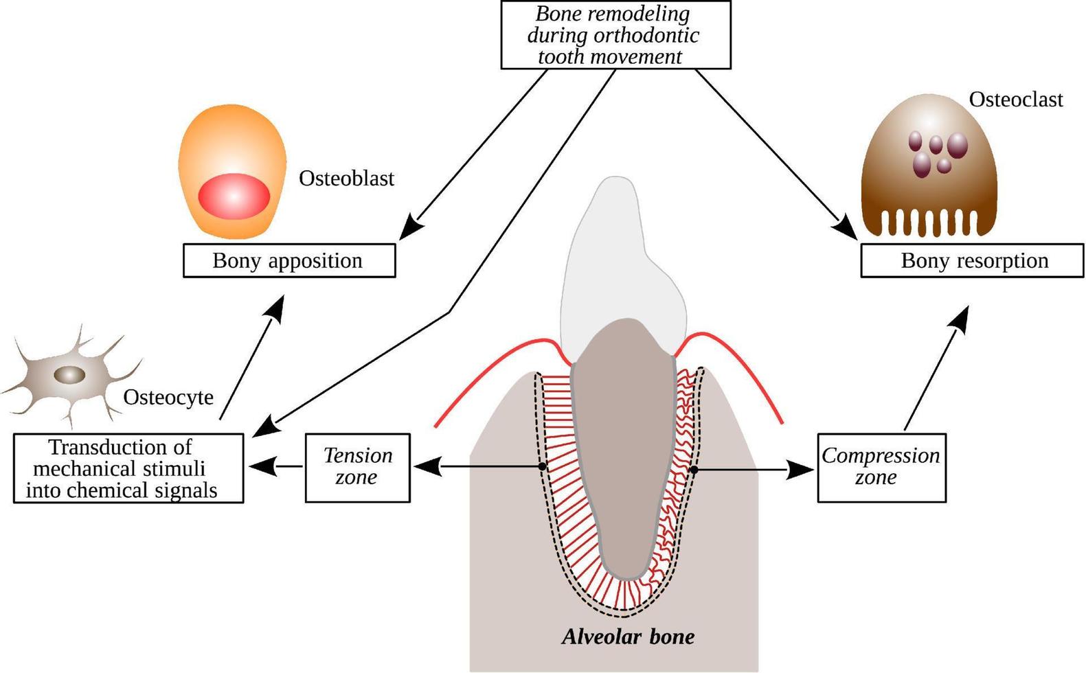 Bone remodeling during orthodontic tooth movement - Bone formation and Bone vector