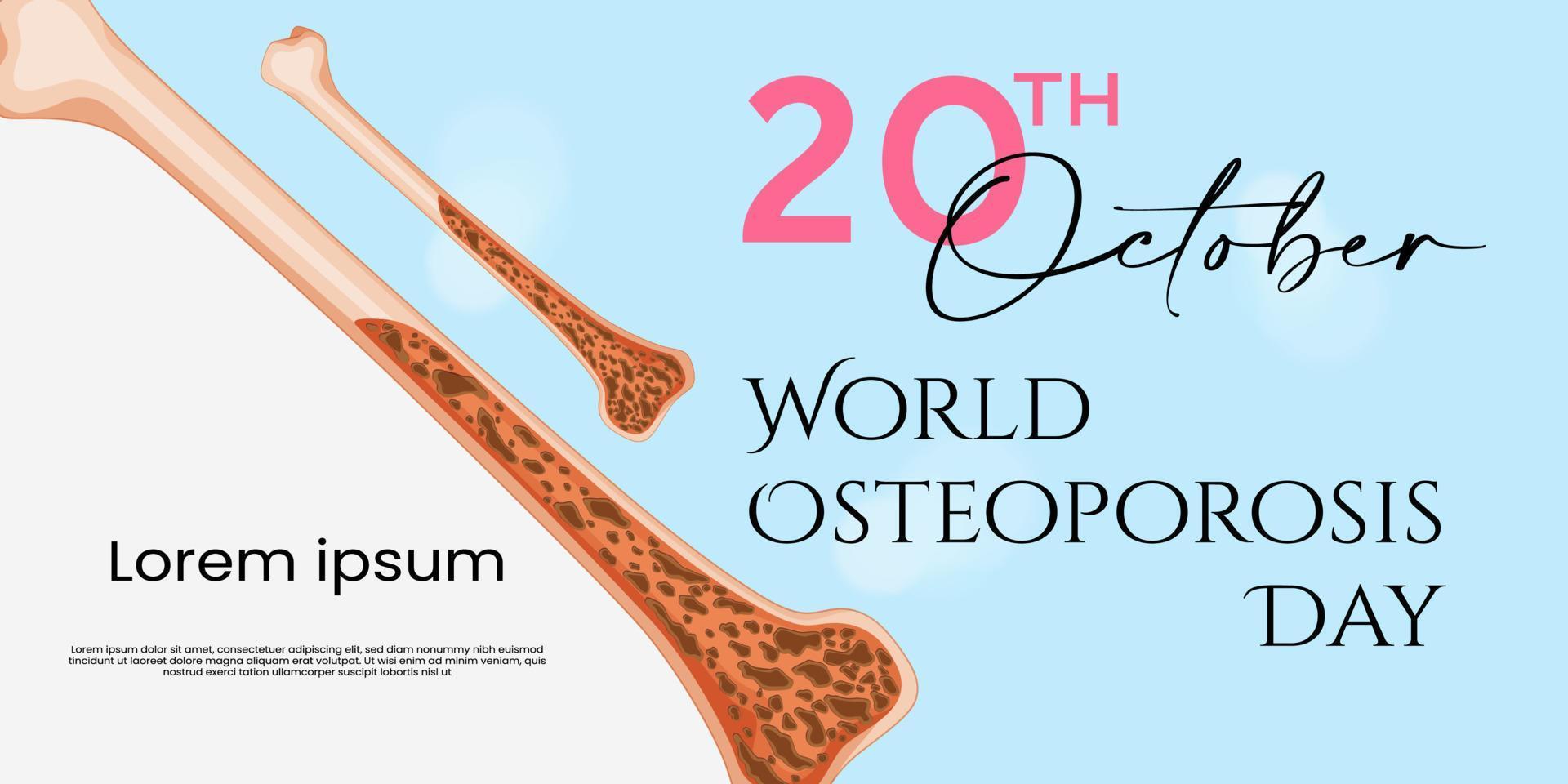 día mundial de la osteoporosis pancarta creativa moderna, signo, concepto de diseño, publicación en medios sociales, plantilla con osteoartritis de huesos anatómicos humanos. vector