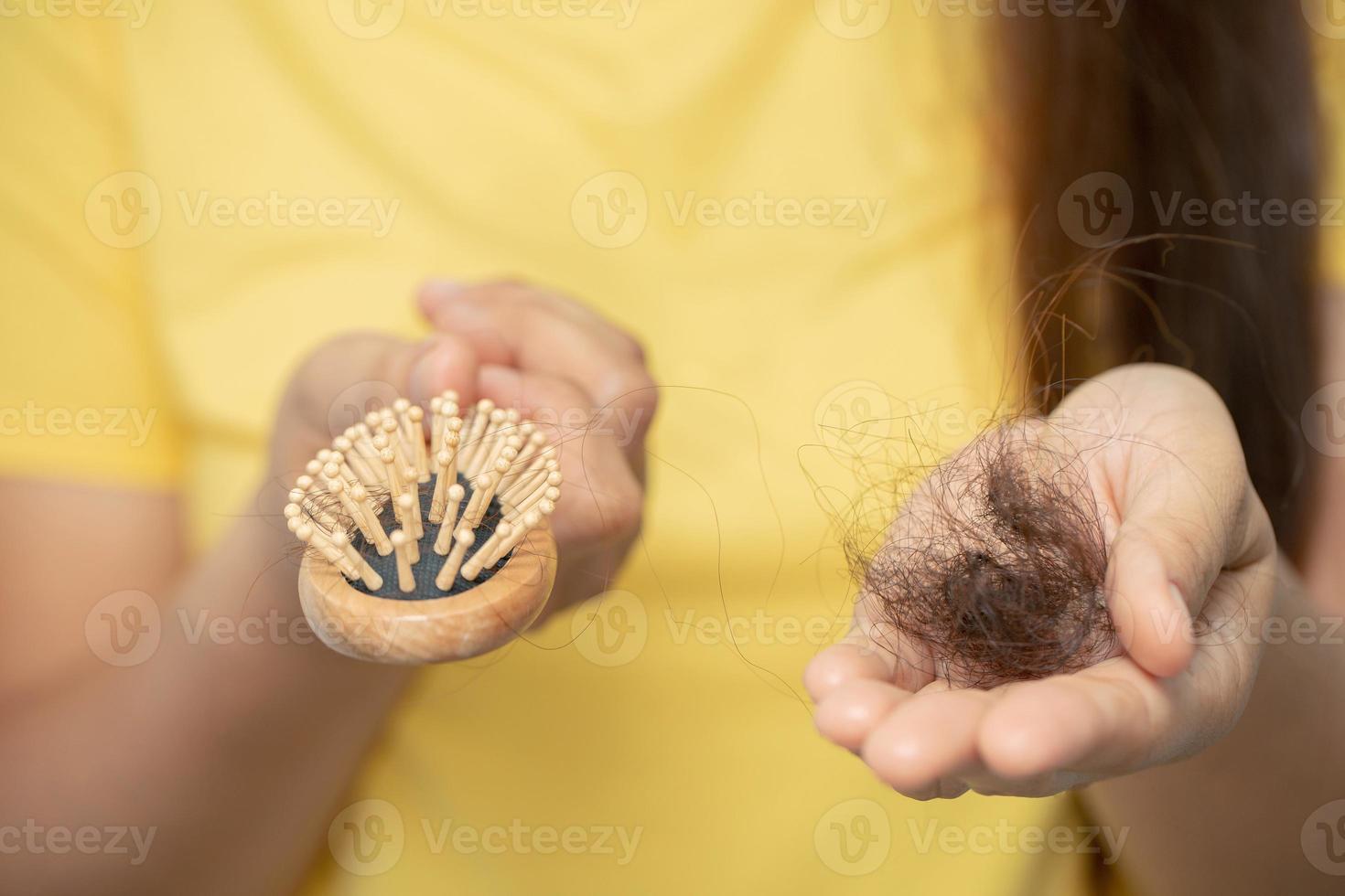 Woman hair loss from shampoo allergy photo