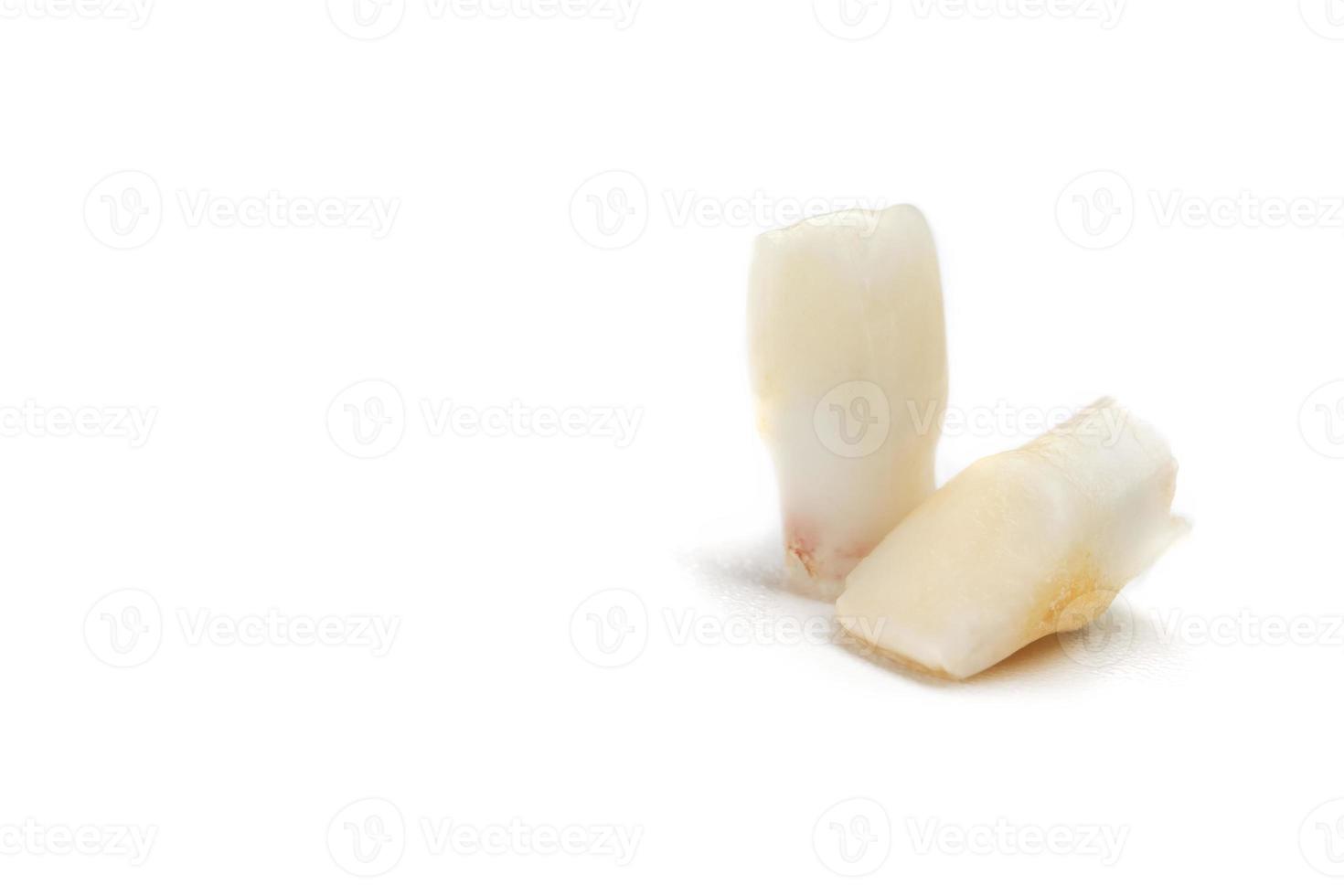 Baby teeth on a white background. Loss of two lower teeth of the child at the stage of formation of the jaw. photo