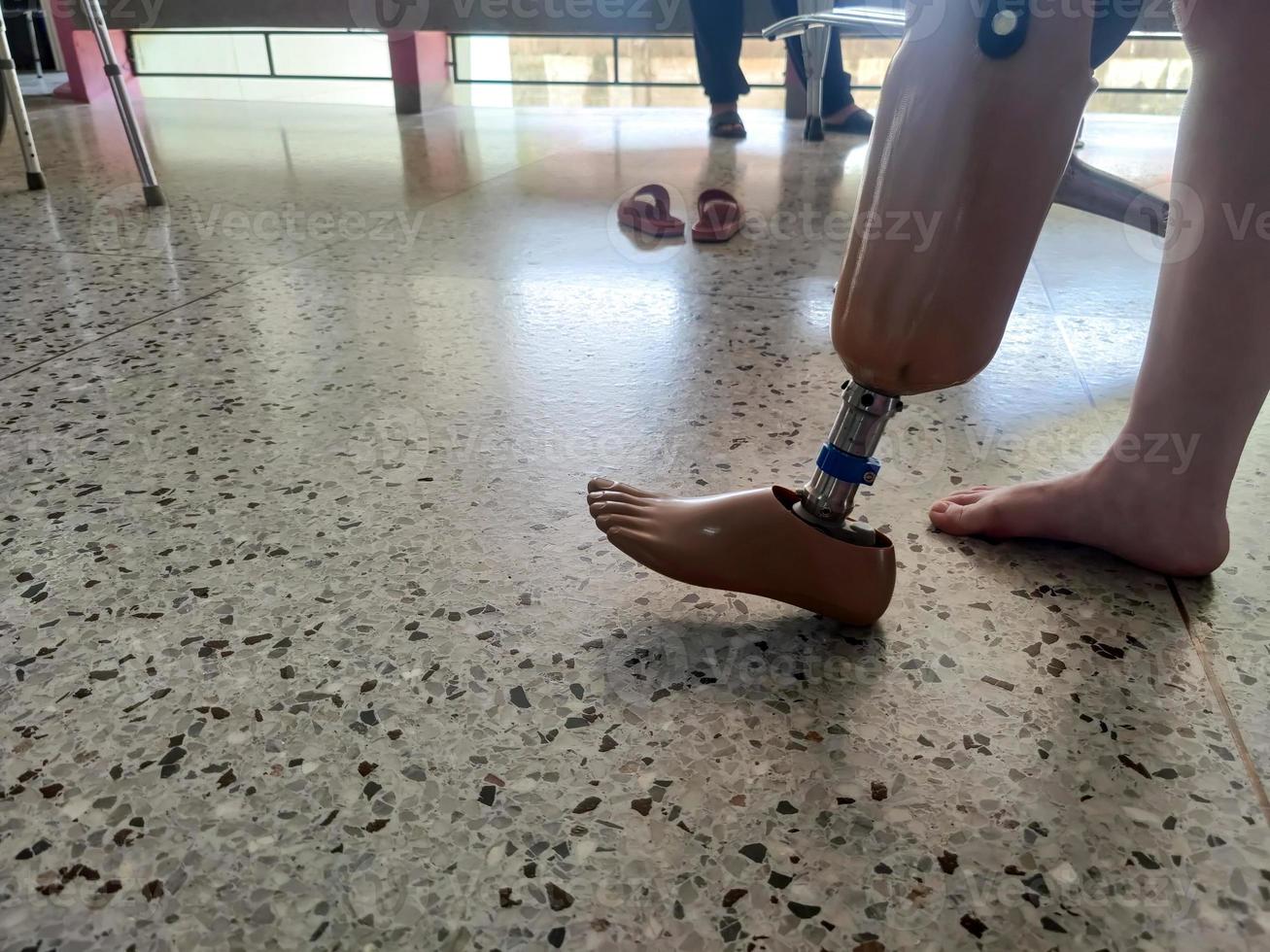 BK disability using and training leg prothesis photo