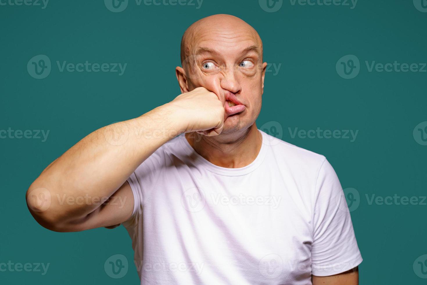 portrait of a bald man punches himself on the cheek, facial expressions photo