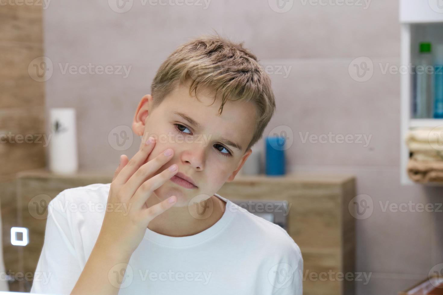 Teenager irritated by dry unhealthy skin, worried about problems with his face. photo