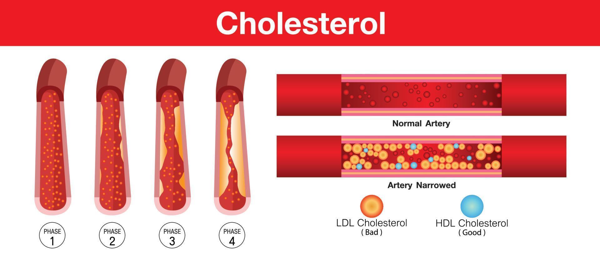 colesterol en la arteria, riesgo para la salud, diseño vectorial vector