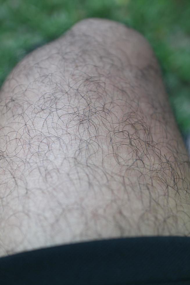 the skin texture of a man's feet is brown full of fur photo