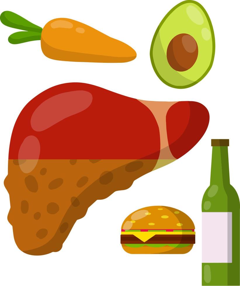 hígado sano y enfermo. causas de la enfermedad el órgano interno. hamburguesa grasienta, cerveza de alcohol, zanahorias, aguacate. diagnostico medico. divertida ilustración plana de dibujos animados. conjunto de dieta y buena nutrición vector