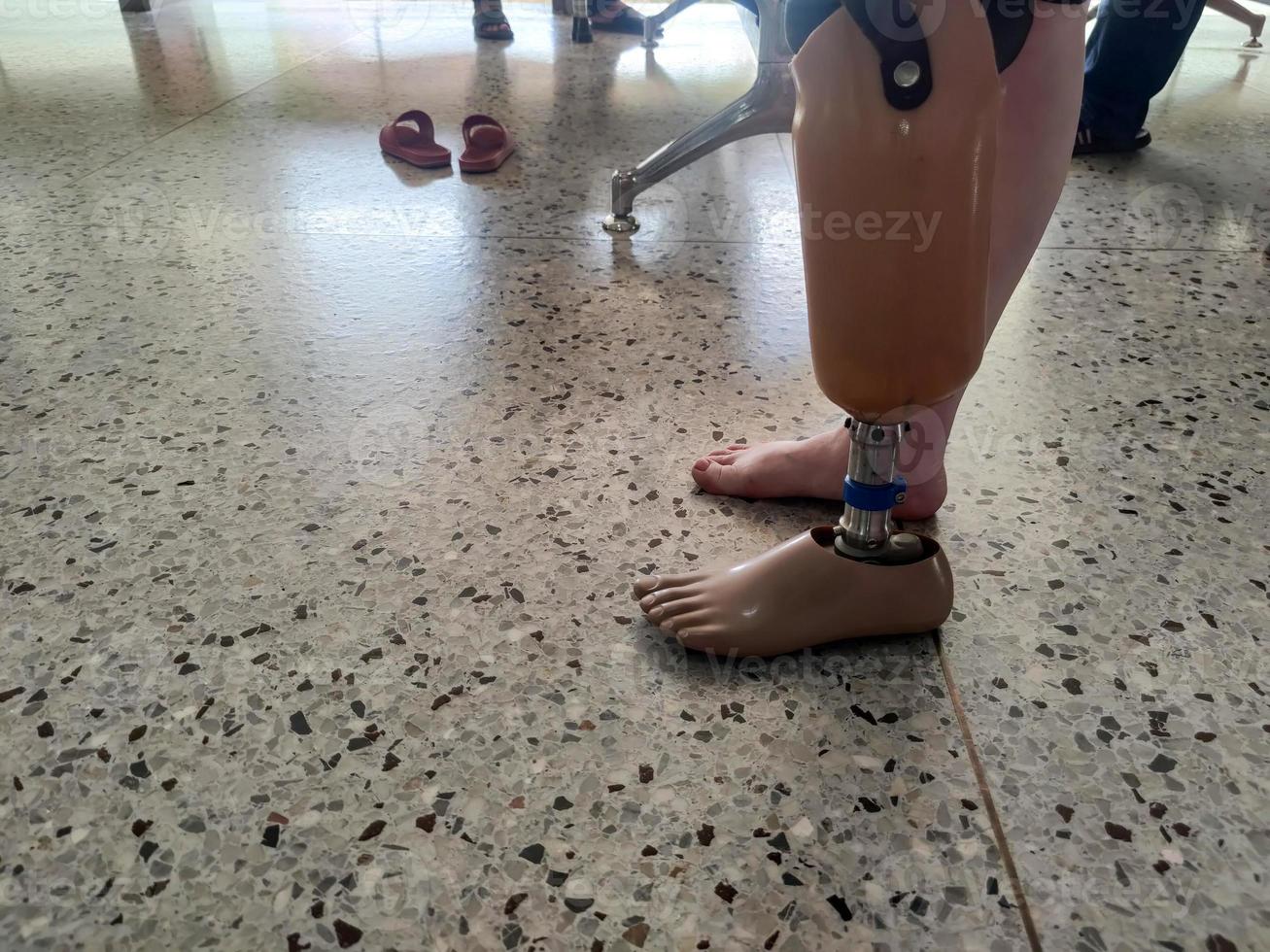 BK disability using and training leg prothesis photo