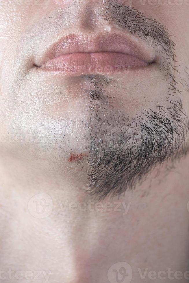 A cut on a man's chin from a sloppy shave. photo