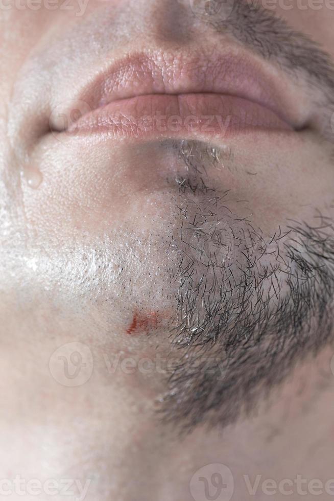 A cut on a man's chin from a sloppy shave. photo