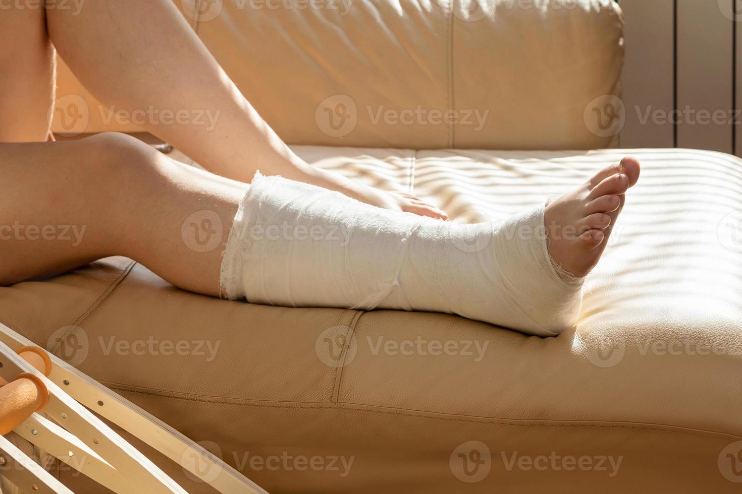 Bandaged leg cast and toes after a running injury accident. Teen girl in a plaster cast. Cropped shot of a girl. Shin splints. photo