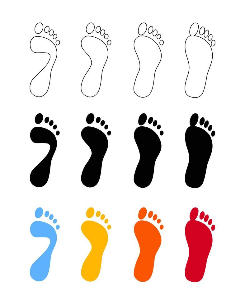 Deformation of the foot. Set of stages of flat feet isoleted on white background vector