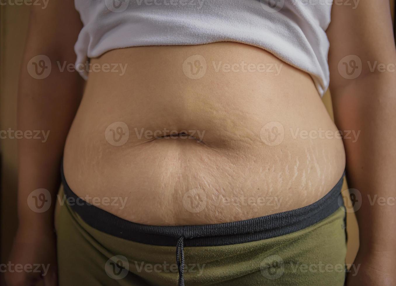 Woman measuring her belly fat with her hands. photo
