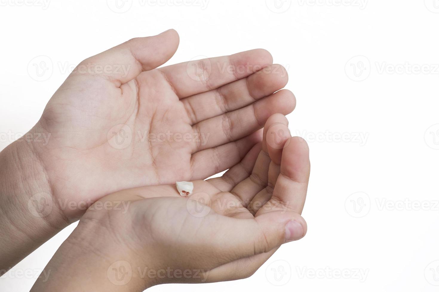 The first dropped baby tooth, in the palms of the child on a white studio background photo