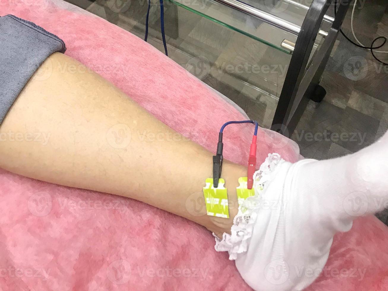 A person is given a bioimpedance medical analysis to diagnose body composition. Sensors are connected to the leg for medical analysis and patient care photo