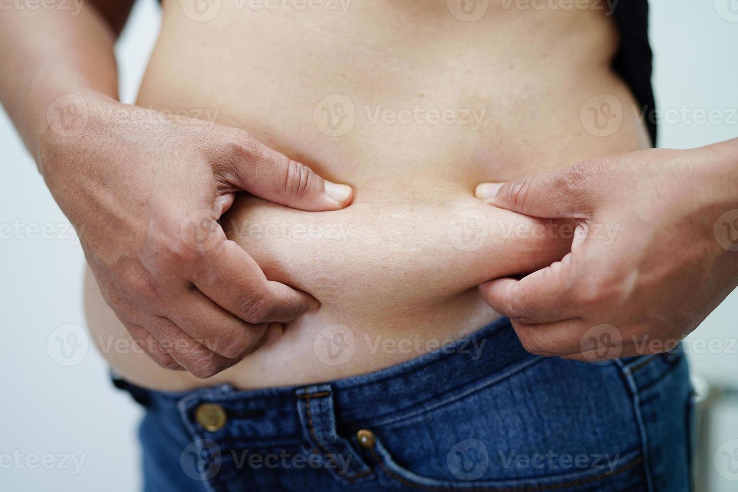 Overweight asian woman use hand to squeeze fat belly big size overweight and obesity. photo