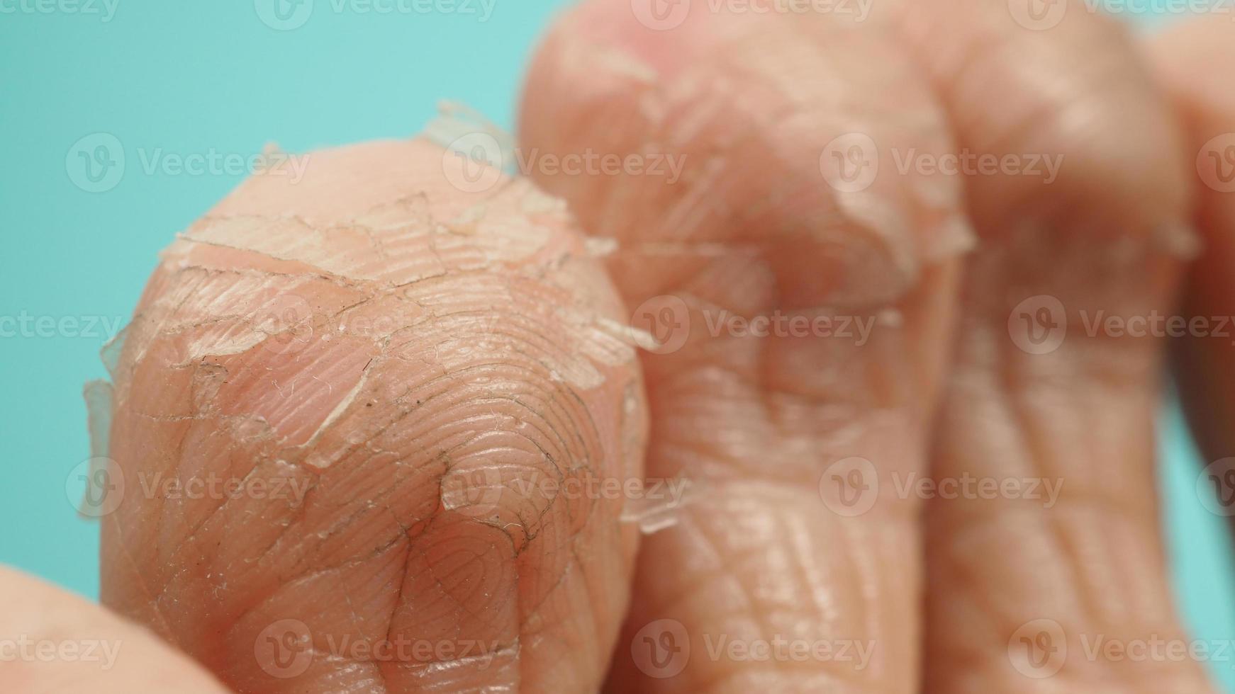 Close up of Foot peeling or remove dead skin on green or tiffany blue background. photo