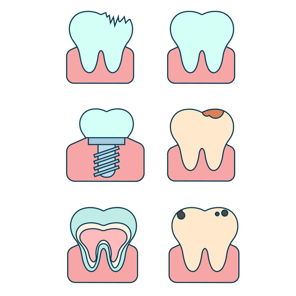 ilustración vectorial plana de dientes en varios estados. diente sano, enfermo vector