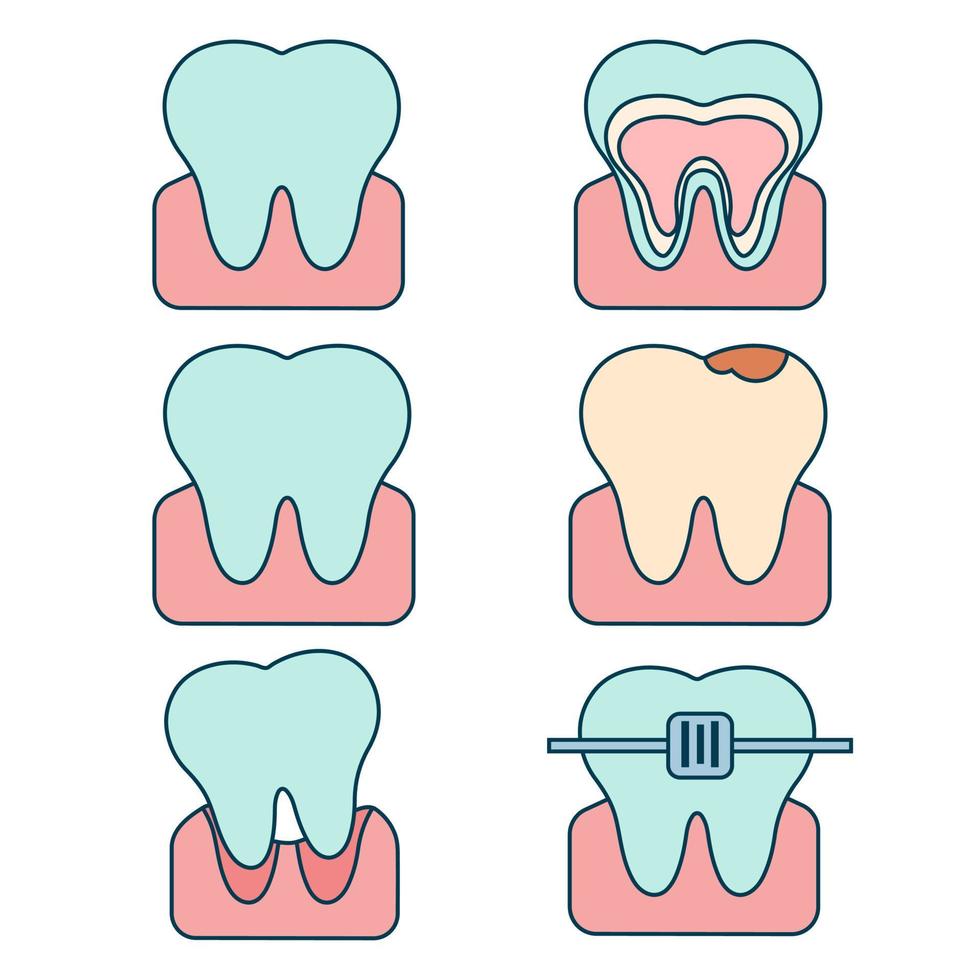 The set of teeth in various states. Vector flat illustration