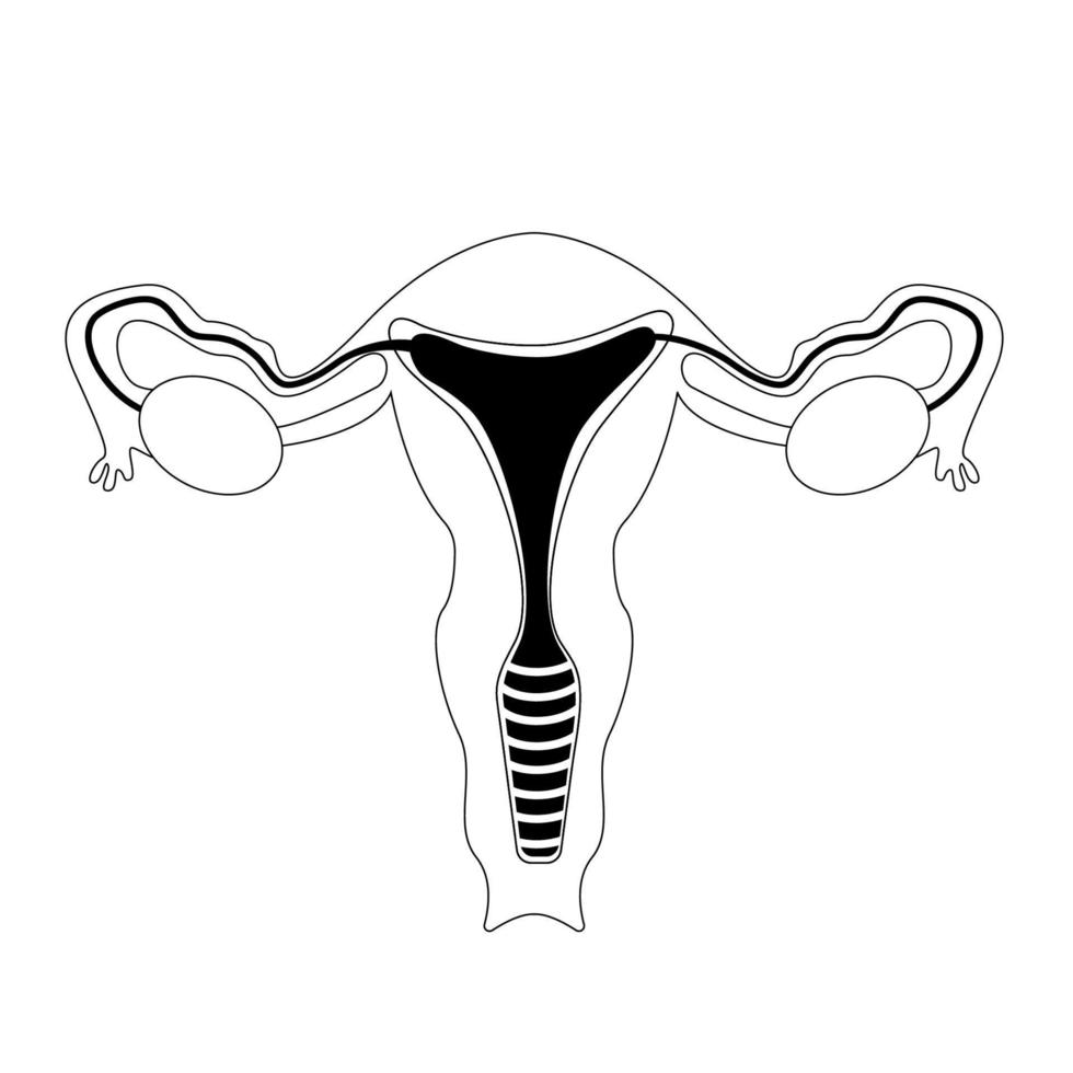 Female genitals outline. Endometriosis, vector illustration