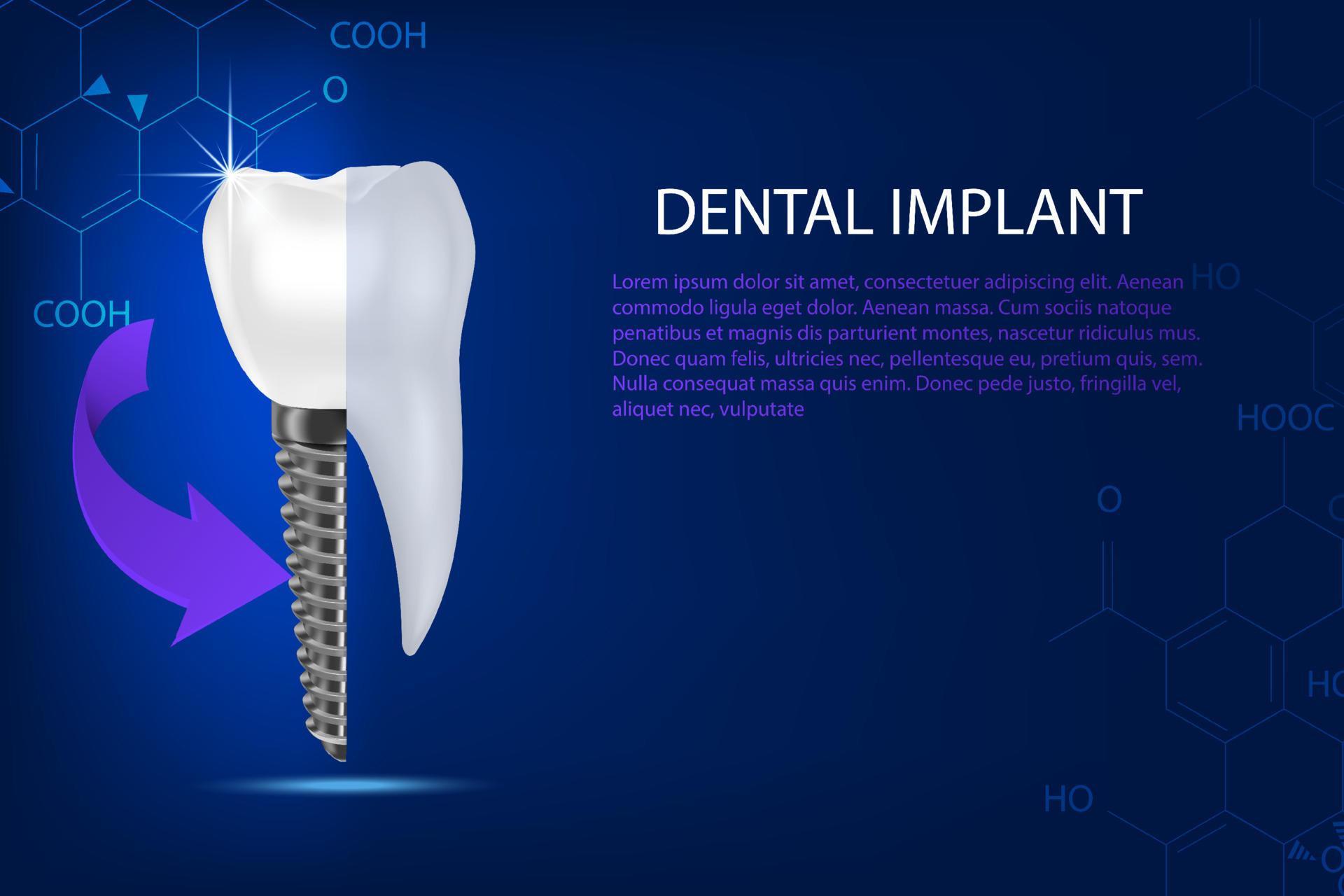 Tooth conditions healthy, dental implant on an abstract blue technology