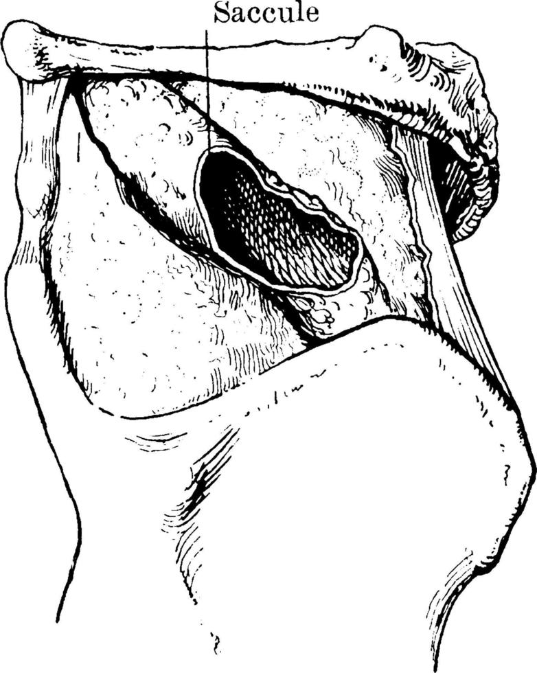 Specimen showing a greater extension of the Saccule of the Larynx, vintage illustration. vector