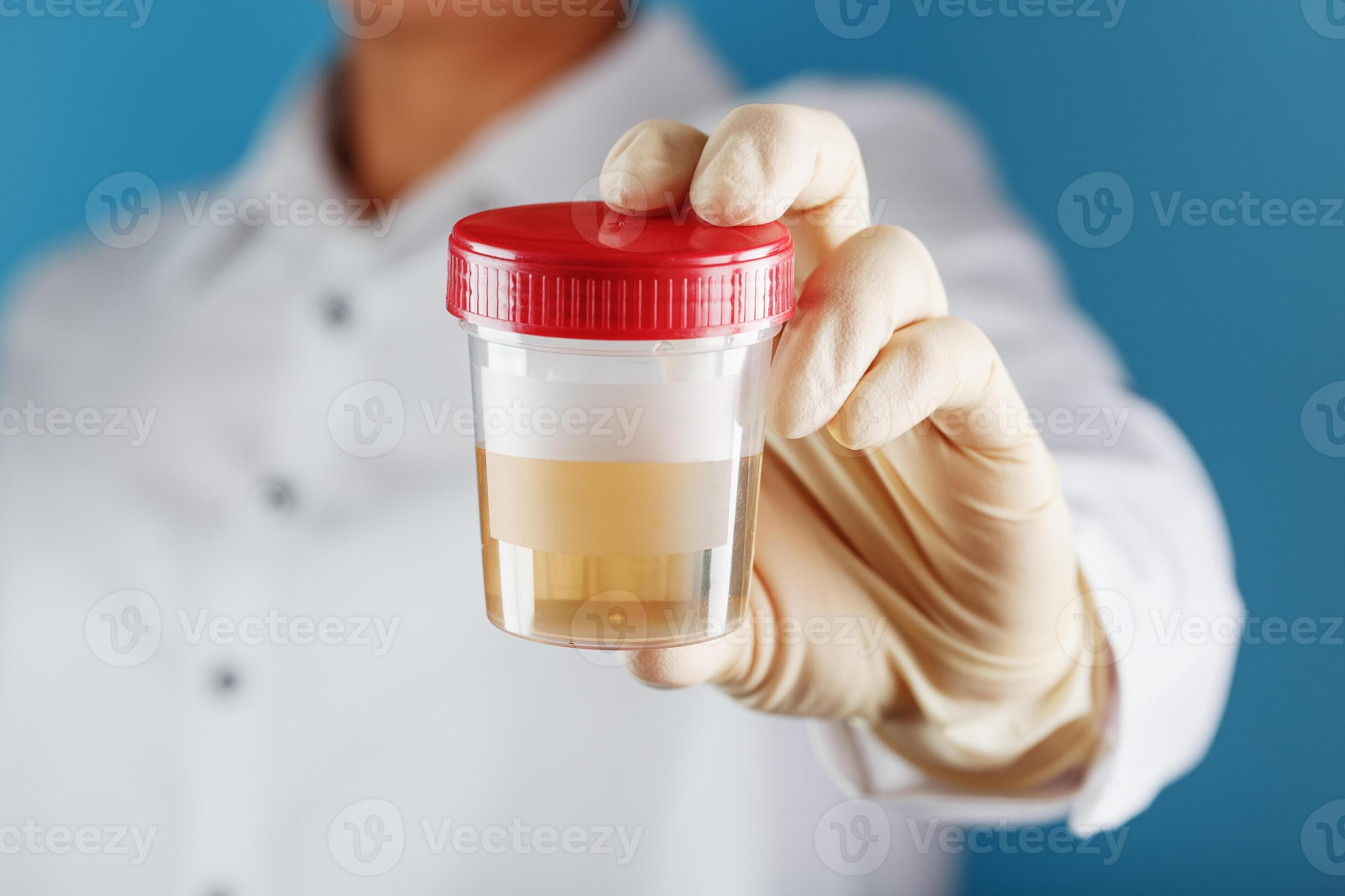 The doctor is holding a plastic can of urine for analysis. 13479067
