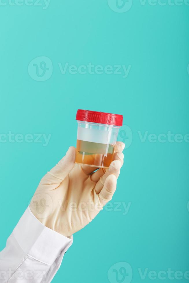 A container for biomaterial with a urine analysis in the hand of a doctor in a white rubber glove on a cyanic background. photo