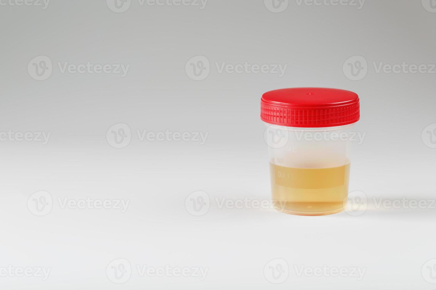 Urine in a jar with a red lid for laboratory analysis on a white
