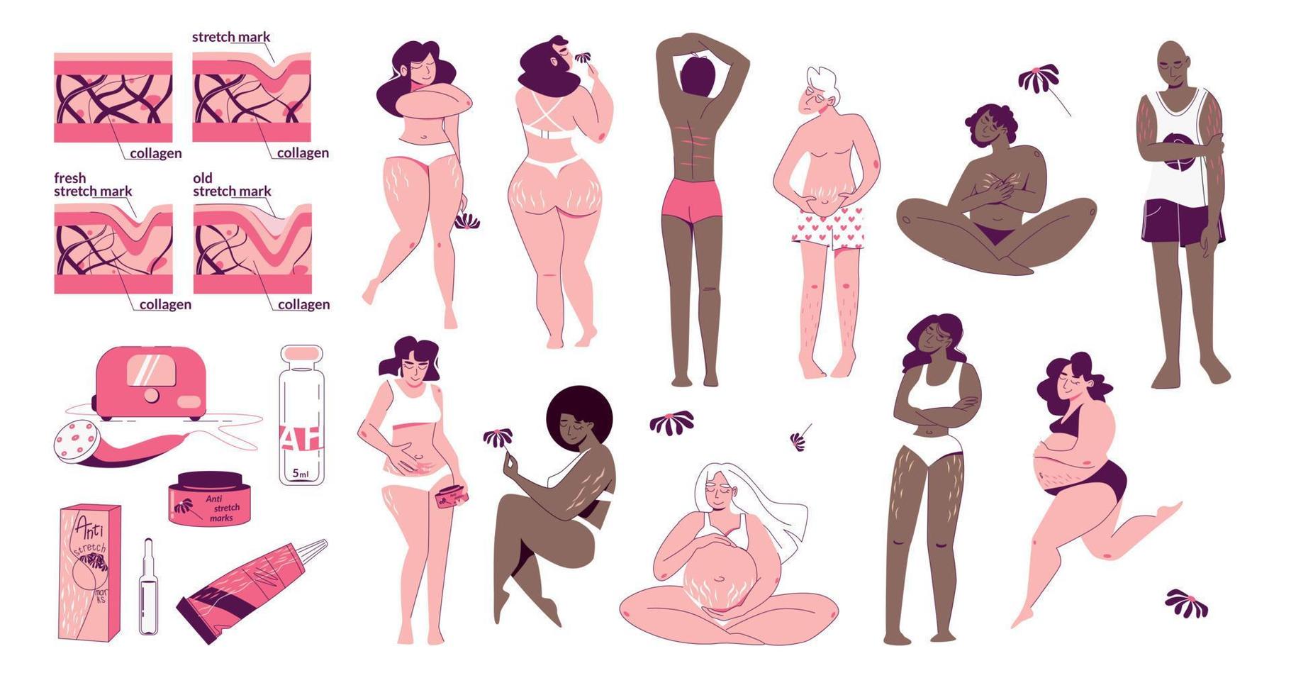 Stretch Marks Flat Set vector