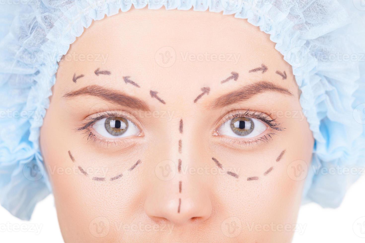 Waiting for plastic surgery. Cropped image of beautiful young woman in medical headwear and sketches on face looking at camera while isolated on white photo