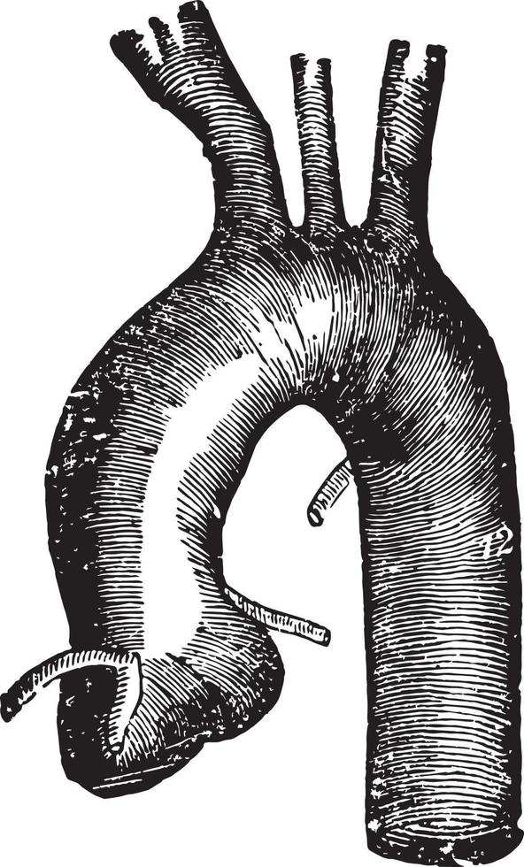 aorta torácica, ilustración vintage. vector