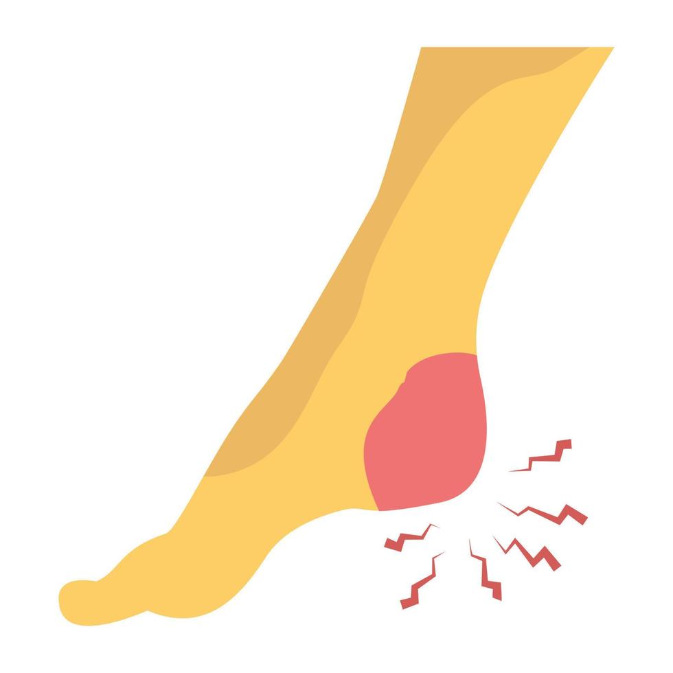 Trendy Heel Pain vector