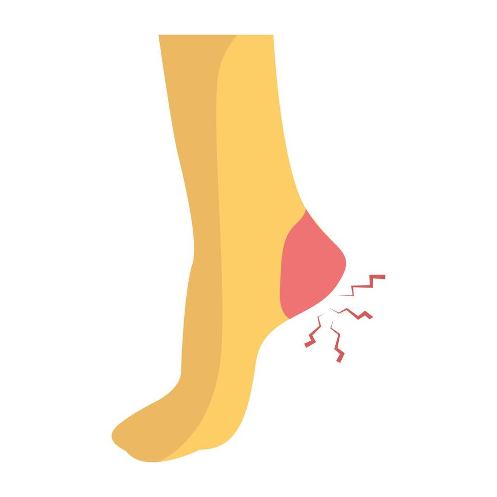 Trendy Heel Pain vector