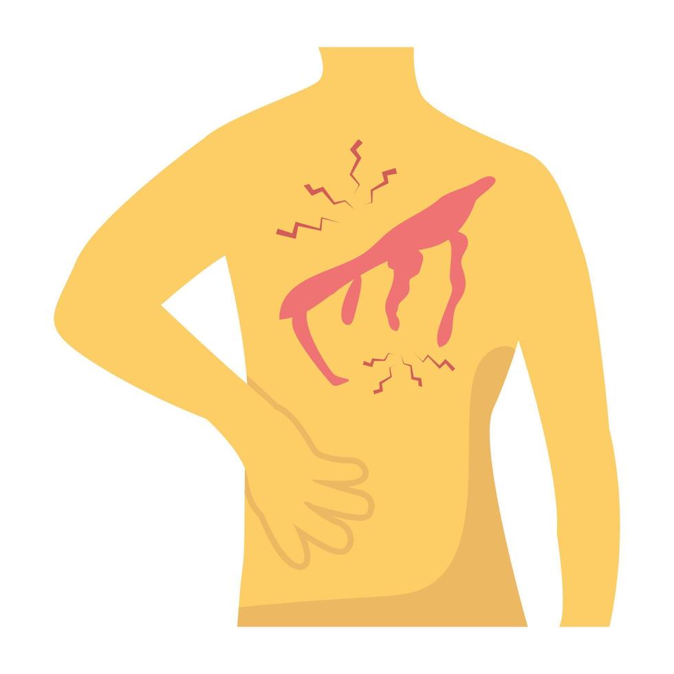 Trendy Backbone Injury vector