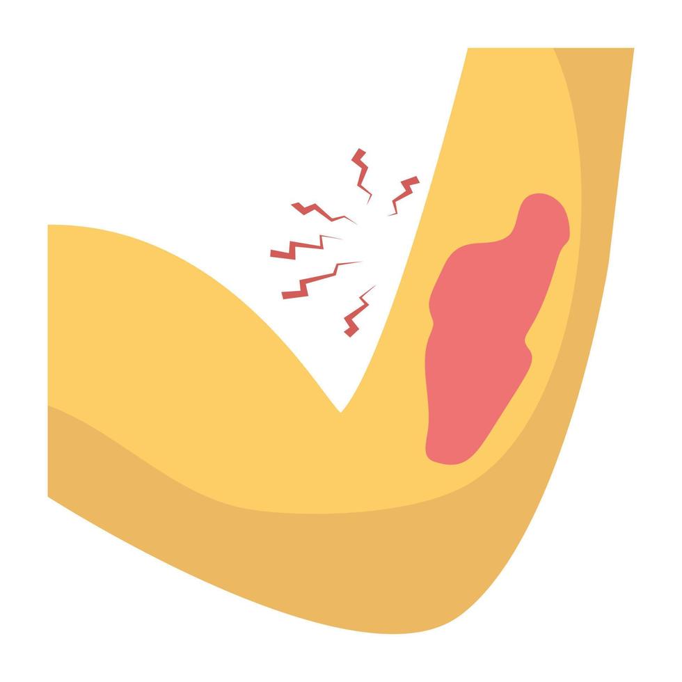 Arm Side Bleeding 13560624 Vector Art at Vecteezy