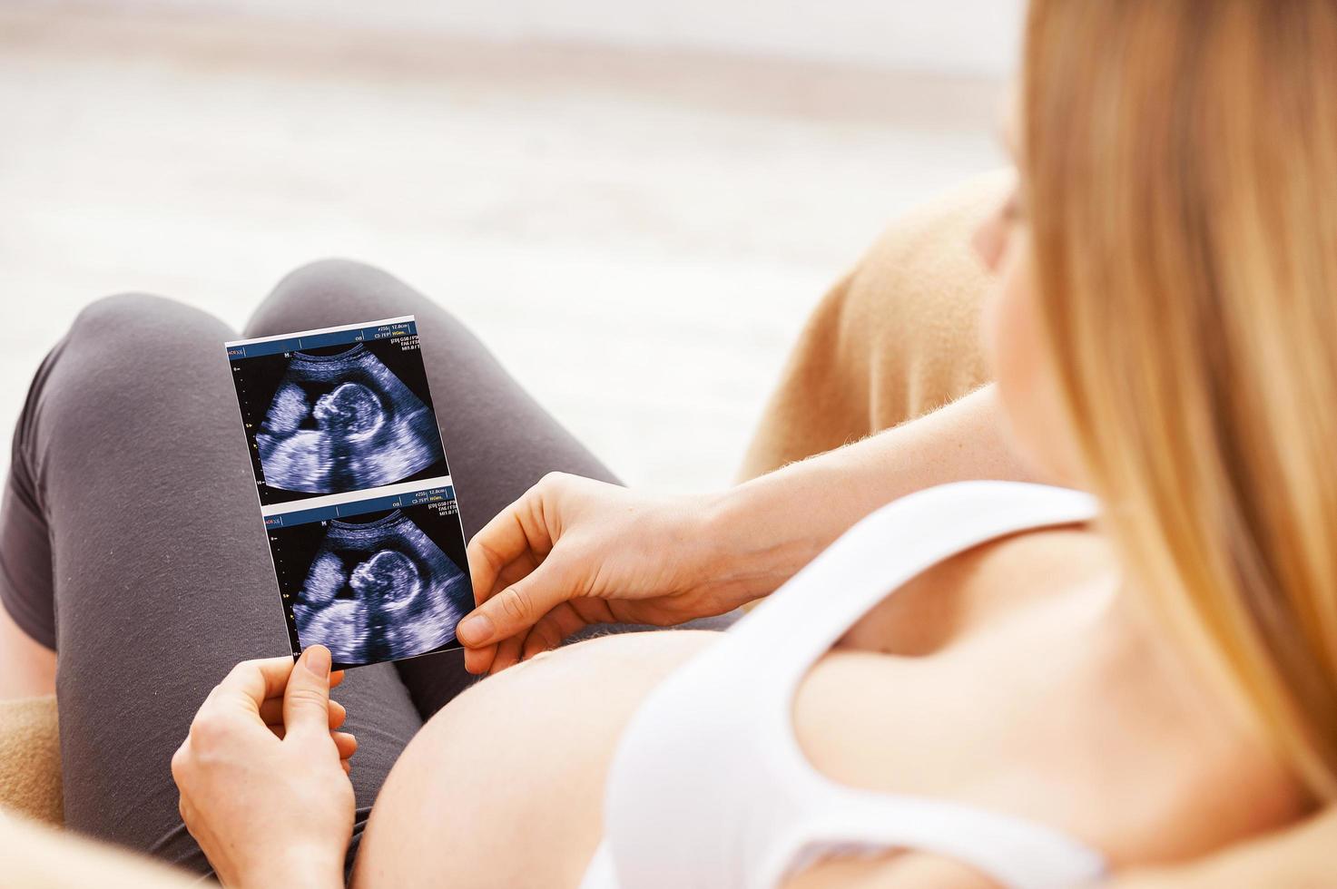 Pregnant woman with x-ray image. Top view of beautiful pregnant woman sitting on the chair and holding x-ray image of her baby photo