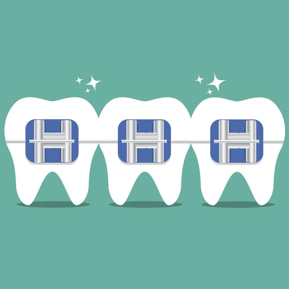 Vector teeth braces flat illustration