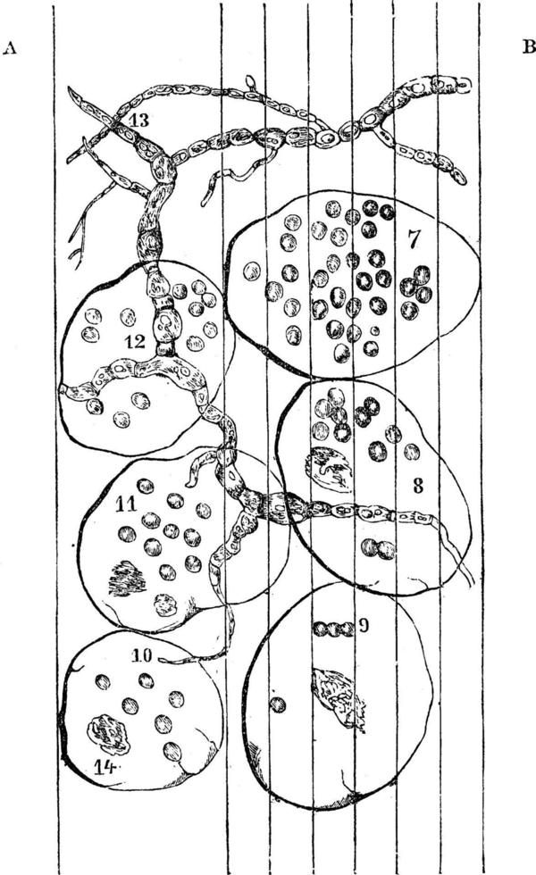 Microscopic view of a fermented apple vintage illustration. vector