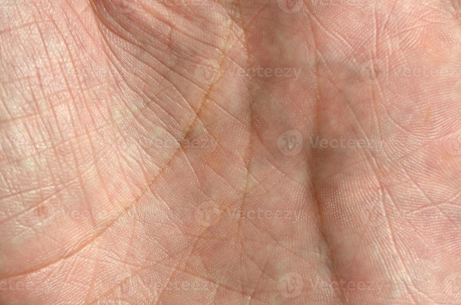 Close up of human hand skin with visible skin texture and lines photo