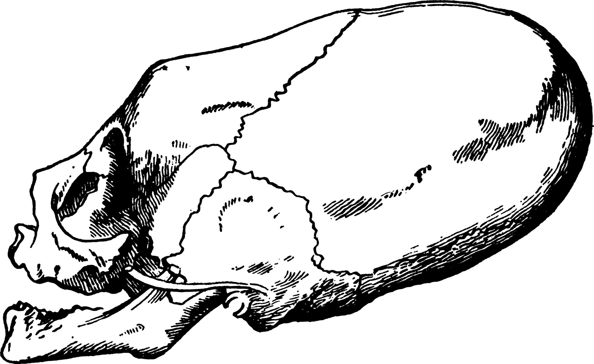 Distorted Skull of Child, vintage illustration. 13609846 Vector Art at