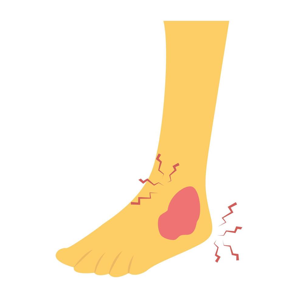 Trendy Ankle Injury vector