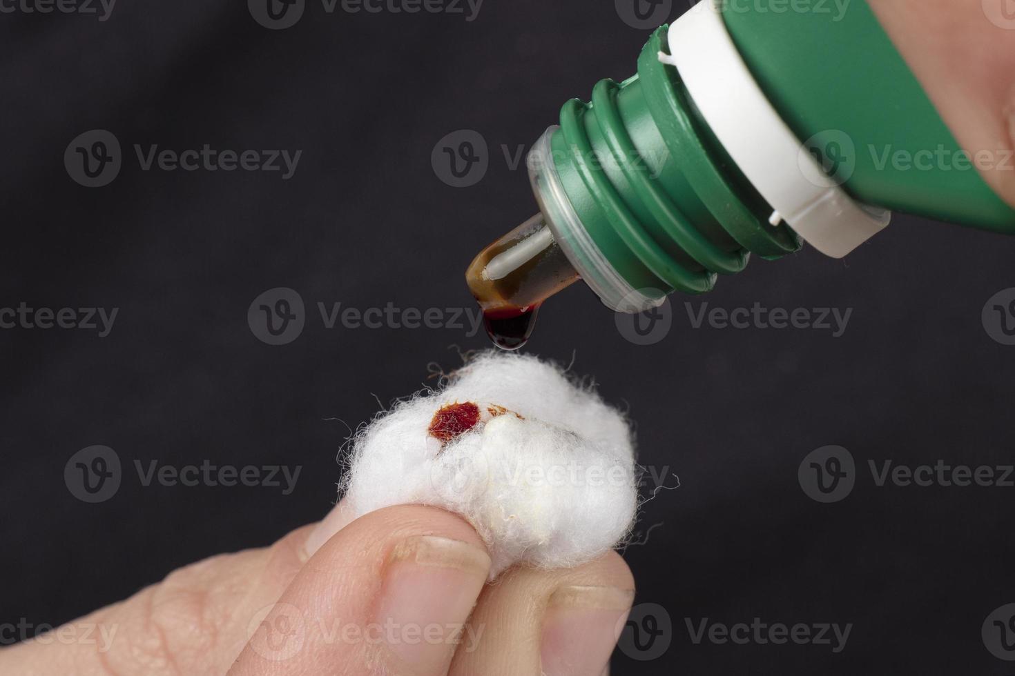 cotton wool and iodine, treatment of radioactive exposure with iodine solution photo