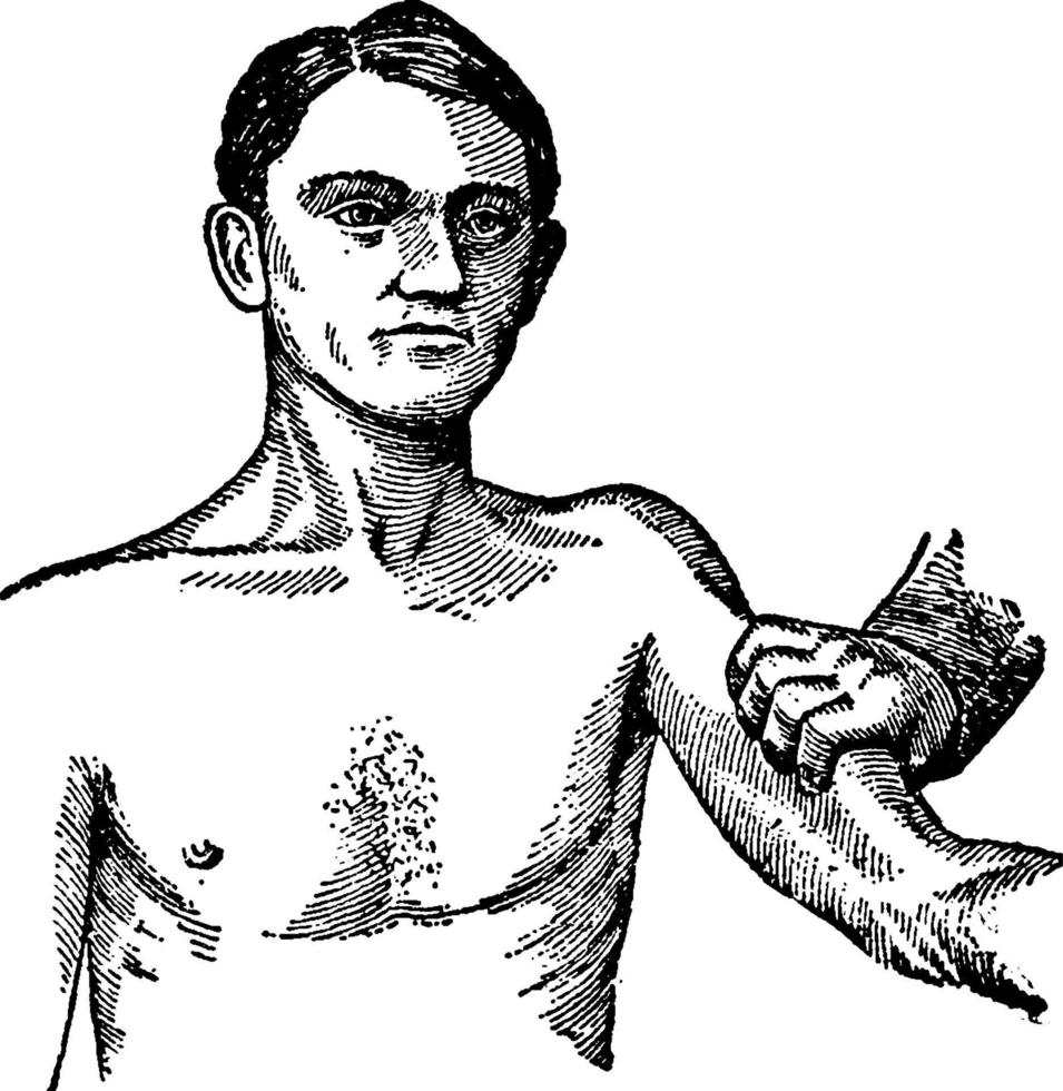 Branchial compression, vintage illustration vector