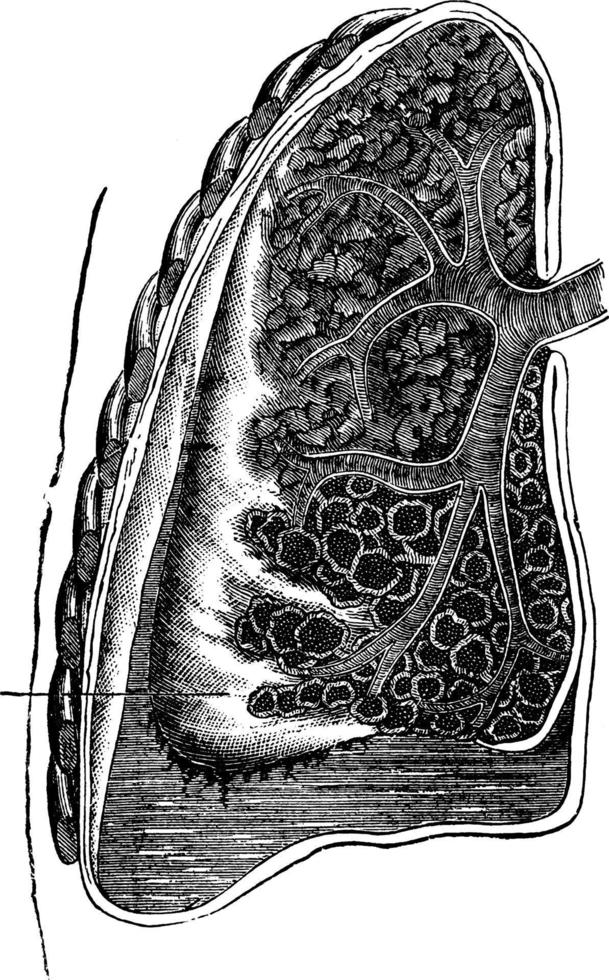 Lungs, vintage illustration. vector