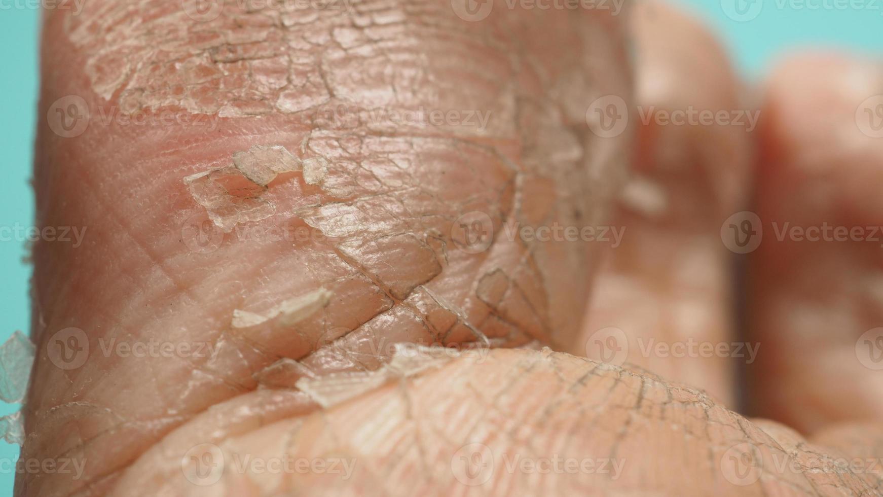 Close up of Foot peeling or remove dead skin on green or tiffany blue background. photo