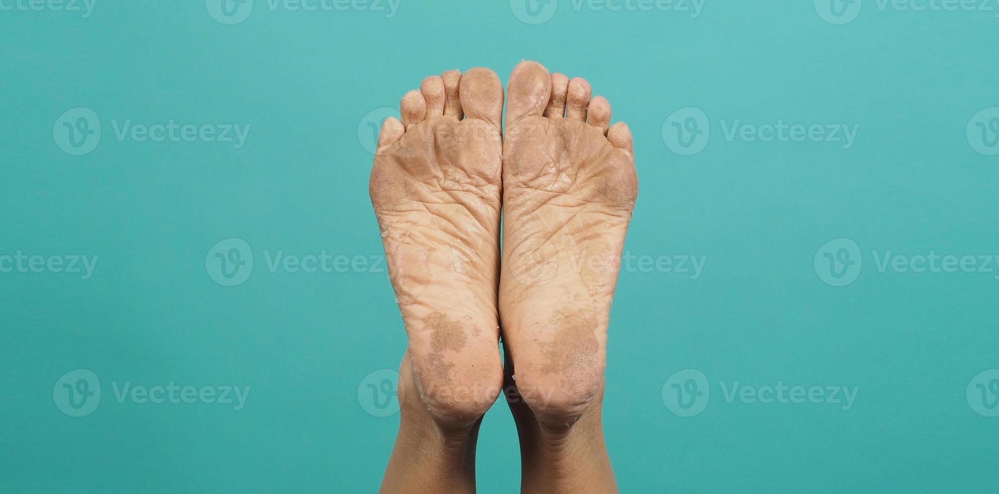 Close up of Foot peeling or remove dead skin on green or tiffany blue background. photo